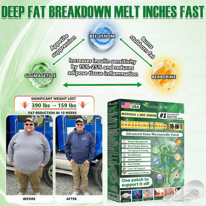 𝐎𝐟𝐟𝐢𝐜𝐢𝐚𝐥 𝐔𝐒 𝐒𝐭𝐨𝐫𝐞 🇺🇸  | 𝐆𝐞𝐞𝐋𝐞𝐦𝐨𝐧® Moringa · Berberine × NAD+ 𝟏𝟎-𝐢𝐧-𝟏 𝐀𝐝𝐯𝐚𝐧𝐜𝐞𝐝 𝐍𝐚𝐧𝐨 𝐌𝐢𝐜𝐫𝐨𝐧𝐞𝐞𝐝𝐥𝐞 𝐏𝐚𝐭𝐜𝐡 — 𝐎𝐧𝐜𝐞 𝐃𝐚𝐢𝐥𝐲, 𝐕𝐢𝐬𝐢𝐛𝐥𝐞 𝐑𝐞𝐬𝐮𝐥𝐭𝐬 𝐢𝐧 𝟕 𝐃𝐚𝐲𝐬